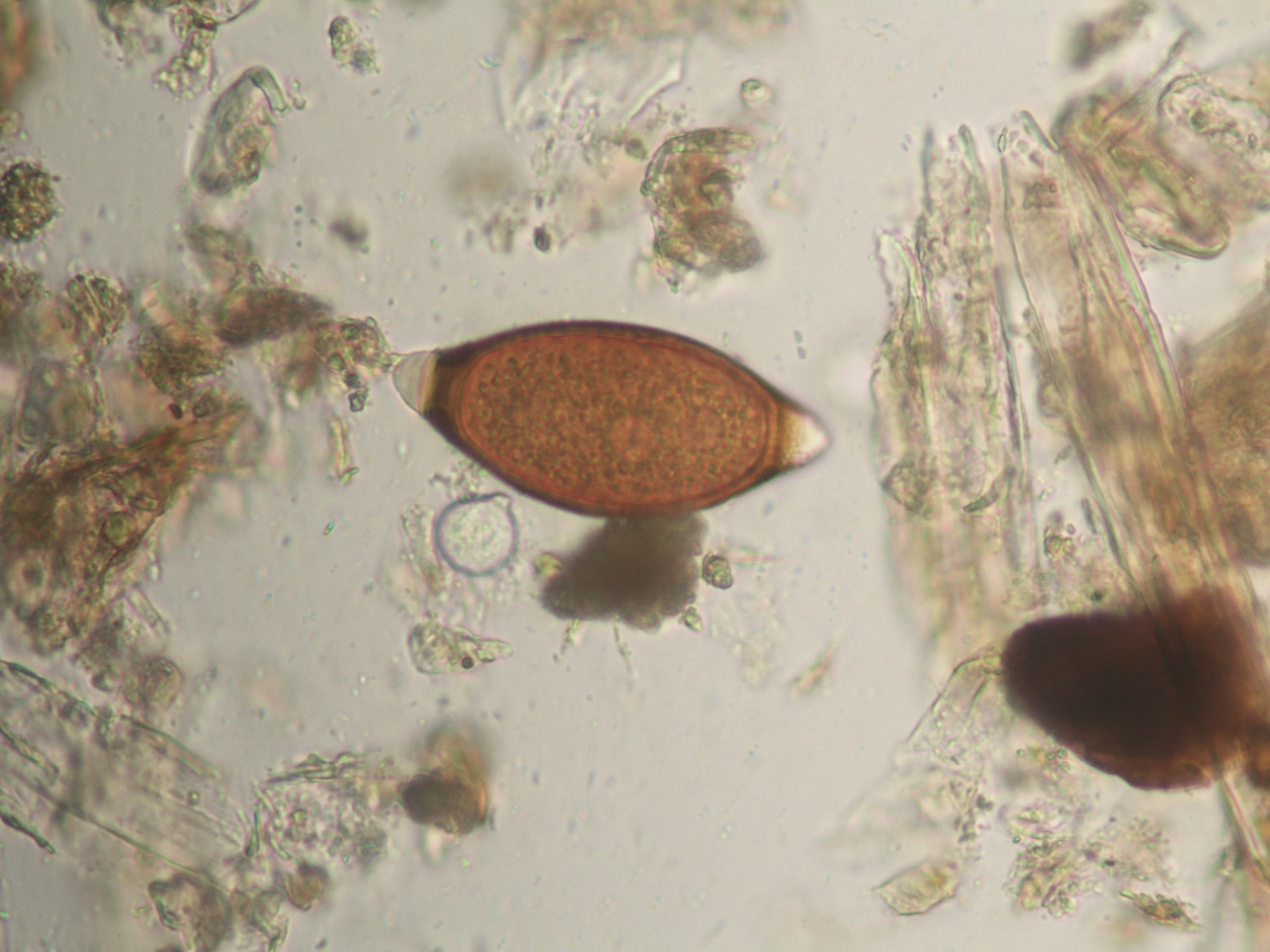 Huevo de Trichuris sp